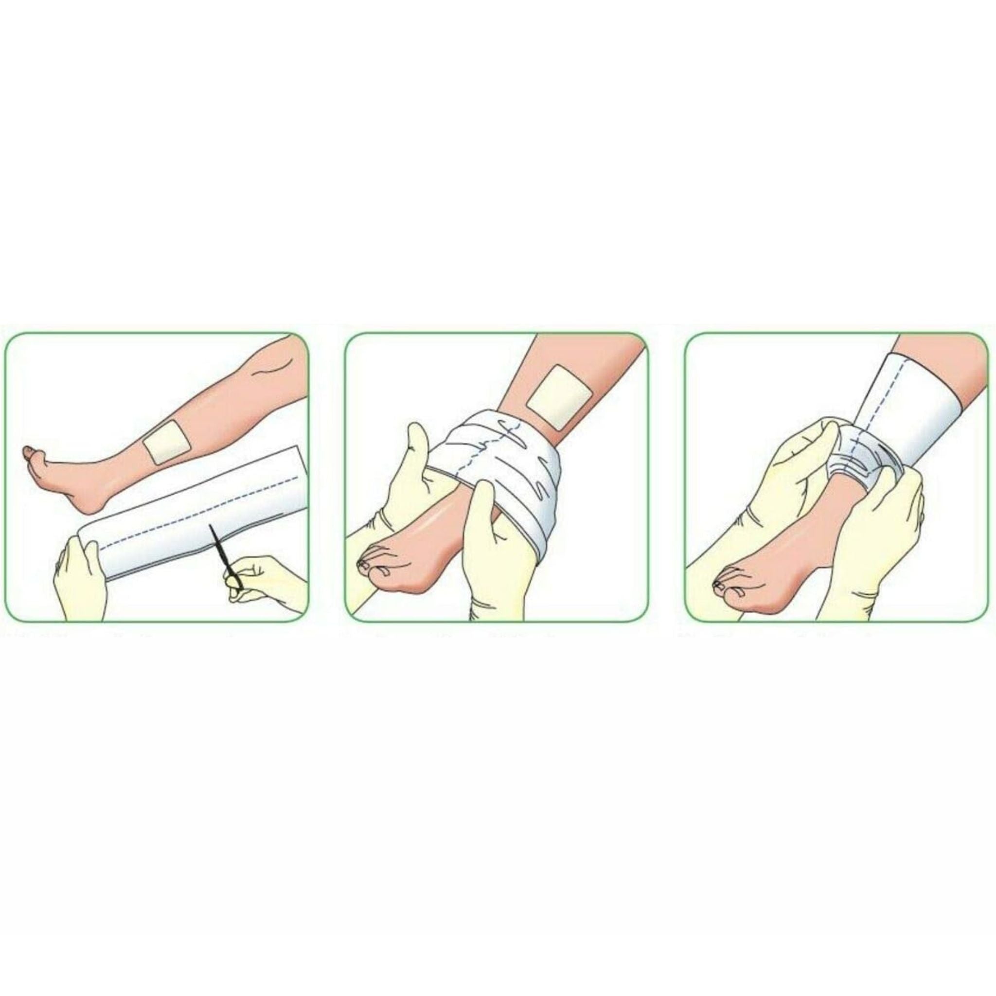 Tubular Bandage Blue Line 7.5cmx10m Millercare Tubular Bandage Blue Line 7.5cmx10m Millercare